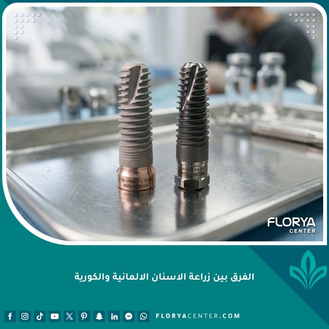 صورة مقربة عالية الدقة توضح الفرق بين زراعة الأسنان الألمانية والكورية وتفاصيل زرعات التيتانيوم.