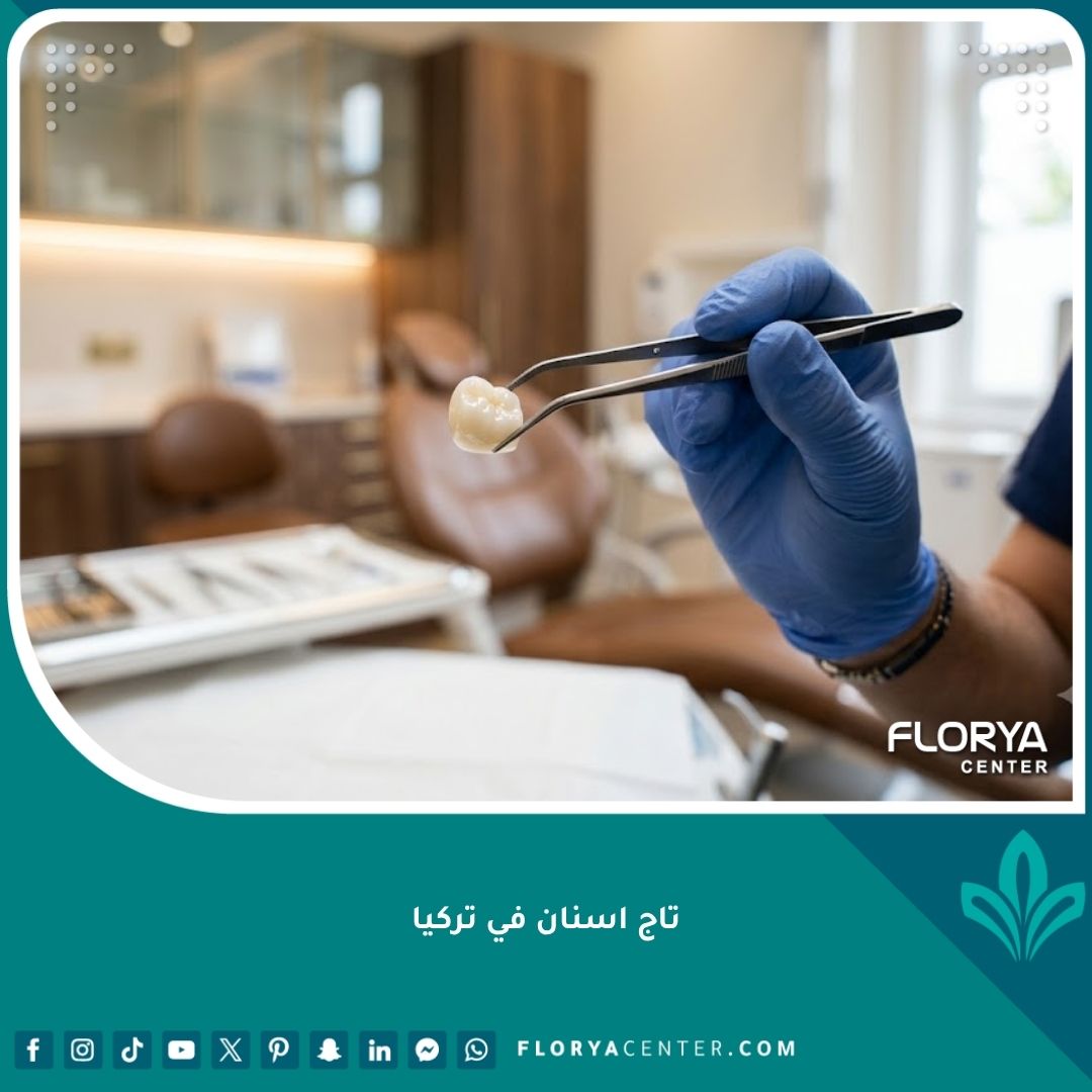 صورة مقربة لطبيب يمسك تاج أسنان بورسلين عالي الجودة، تبرز دقة تصميم تركيبات وتلبيسات الأسنان في تركيا.