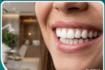 ابتسامة ناصعة البياض توضح نتائج تبييض الأسنان الداخلي في تركيا.