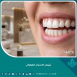 صورة مقربة لابتسامة ناصعة البياض وجميلة بعد الخضوع لجلسة تبييض الاسنان الكيميائي الاحترافي.