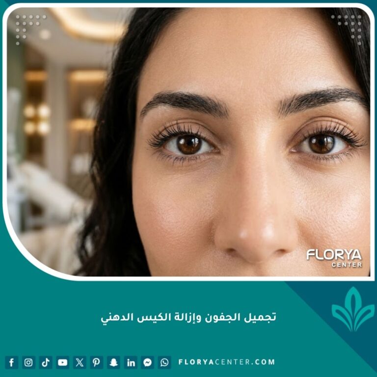 صورة مقربة لعينين جميلتين ووجه مشرق بعد نجاح عملية تجميل الجفون وإزالة الكيس الدهني.