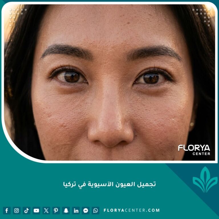 صورة سينمائية لامرأة آسيوية بعيون محددة وجميلة تطل على البوسفور بعد عملية تجميل الجفن المزدوج في تركيا.
