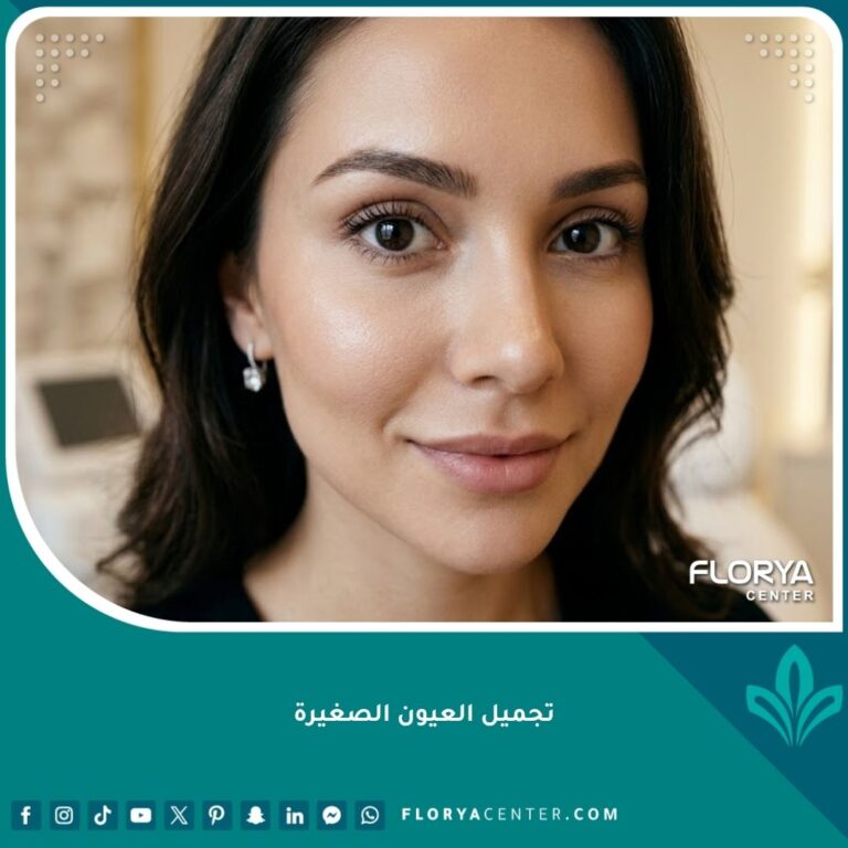 صورة مقربة تبرز جمال العيون الواسعة والجاذبية بعد عملية تجميل العيون الصغيرة.