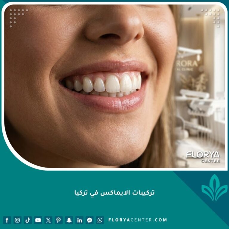 ابتسامة هوليوود شديدة الشفافية باستخدام تركيبات الايماكس للأسنان الأمامية في تركيا
