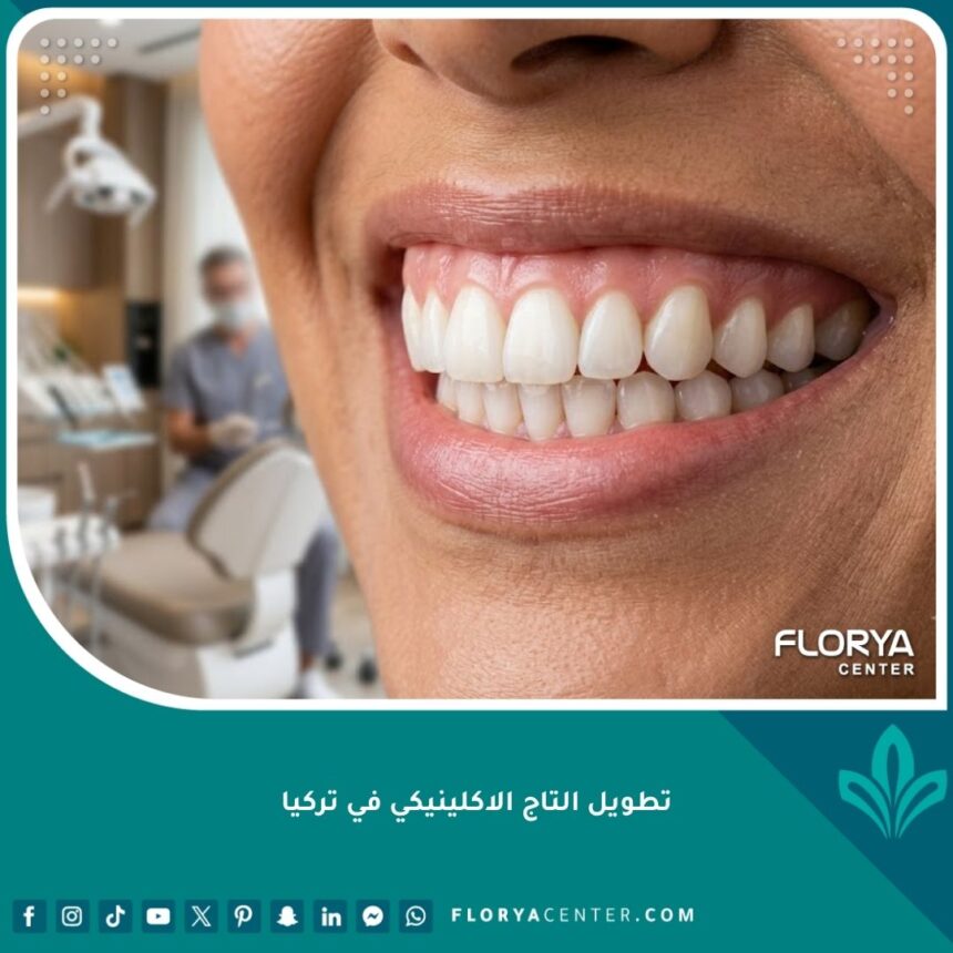 صورة مقربة لابتسامة مثالية تبرز جمال اللثة والأسنان، تمثل النتيجة النهائية لعملية تطويل التاج الاكلينيكي في تركيا.