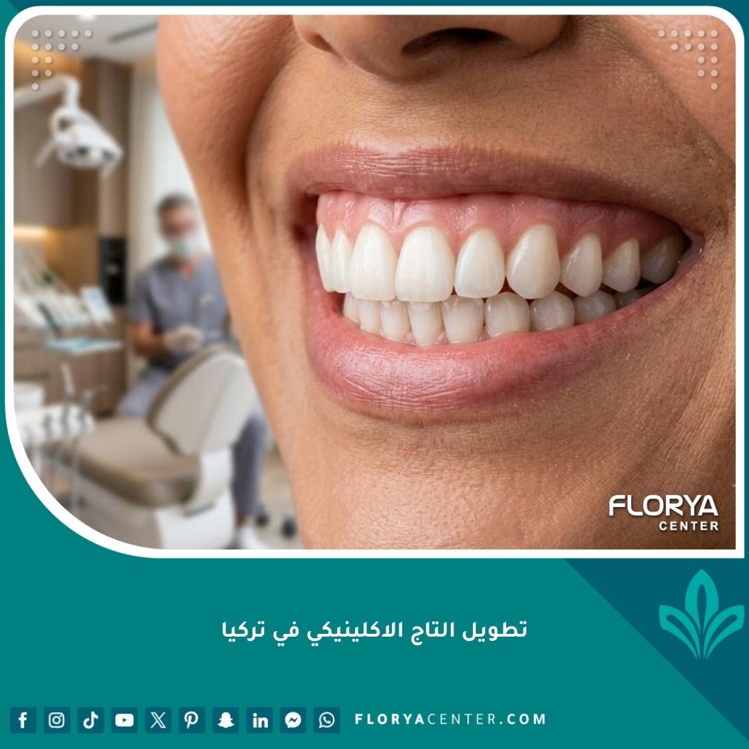 صورة مقربة لابتسامة مثالية تبرز جمال اللثة والأسنان، تمثل النتيجة النهائية لعملية تطويل التاج الاكلينيكي في تركيا.