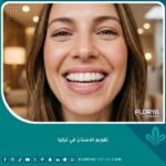 صورة عالية الدقة لابتسامة جذابة مع تقويم أسنان شفاف حديث، كصورة رئيسية لدليل تقويم الاسنان في تركيا.