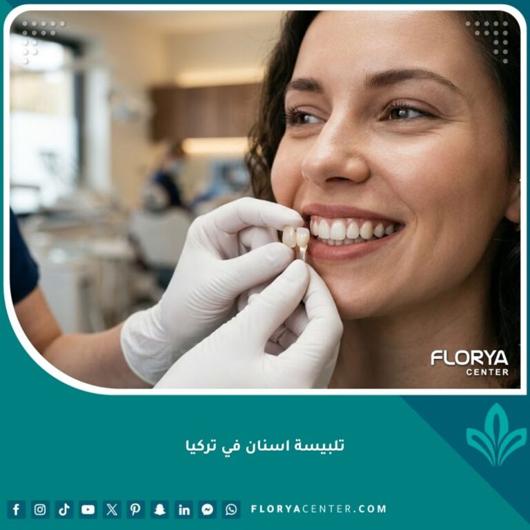 صورة عالية الدقة لابتسامة مثالية تبرز جودة وجمال تلبيسة اسنان في تركيا.