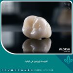 تلبيسة زيركون نقية وشفافة تعكس الجودة العالية في تجميل الأسنان وتتميز بالصلابة والمظهر الطبيعي.