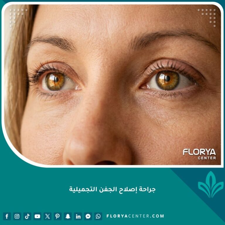 صورة مقربة تبرز نتائج جراحة إصلاح الجفن التجميلية واستعادة المظهر الطبيعي للعين بعد الترميم.