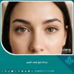 صورة مقربة لعينين جذابتين بعد جراحة رفع طرف العين، تبرز الشكل اللوزي الجذاب ونتائج عملية سحب زاوية العين الخارجية بنجاح.