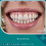 صورة مقربة لابتسامة مثالية تبرز جودة وجمالية تركيب جسر اسنان في تركيا بمظهر طبيعي.