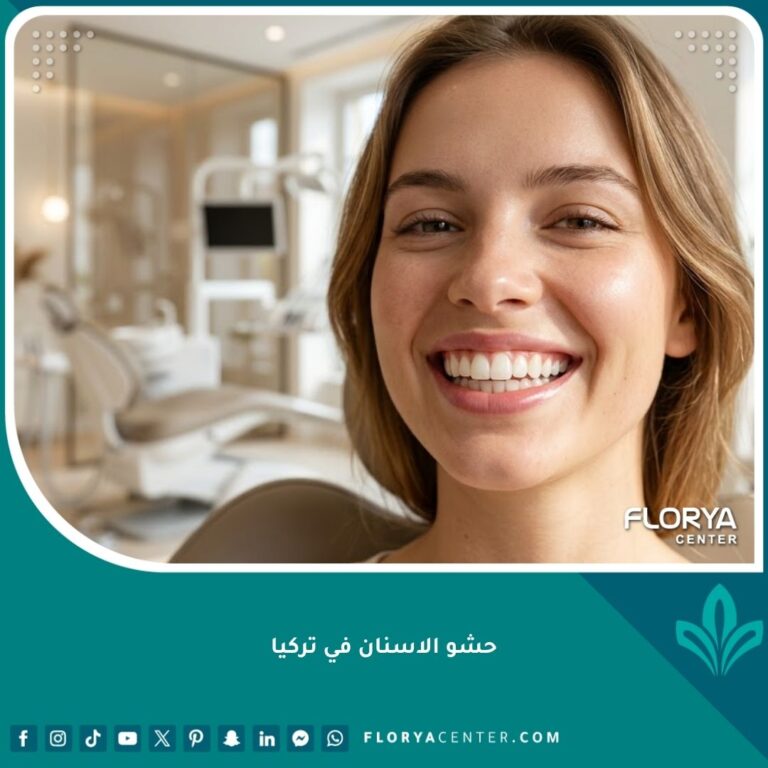 ابتسامة صحية وناصعة البياض لامرأة بعد إجراء حشو الاسنان في تركيا وعلاج التسوس.