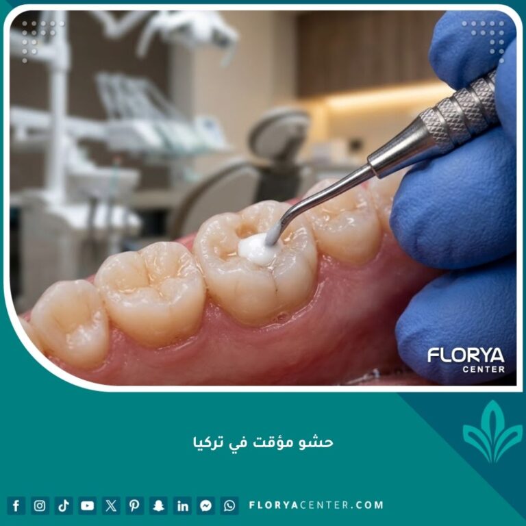 صورة مقربة تظهر طبيب أسنان يضع حشو مؤقت للأسنان بدقة داخل عيادة متطورة في تركيا.