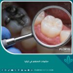 صورة مقربة تظهر استبدال حشوات الاملغم الفضية القديمة بحشوات تجميلية بيضاء حديثة وآمنة في تركيا.