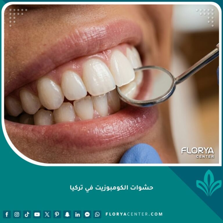 صورة مقربة لابتسامة طبيعية ناصعة البياض تبرز دقة وجمال حشوات الكومبوزيت التجميلية في تركيا.