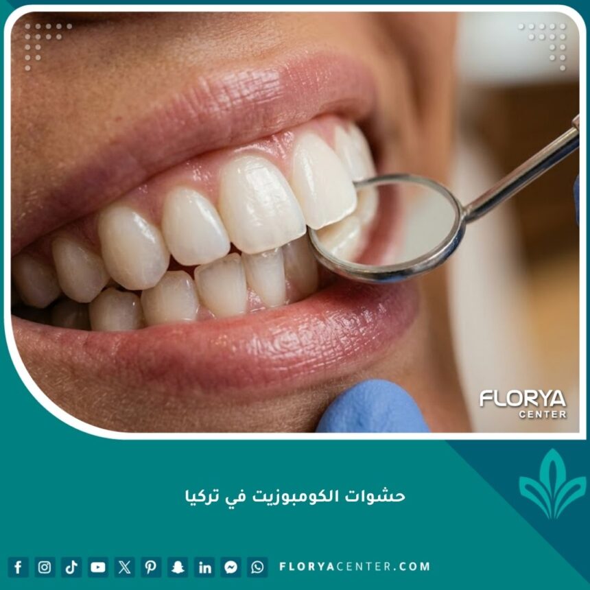 صورة مقربة لابتسامة طبيعية ناصعة البياض تبرز دقة وجمال حشوات الكومبوزيت التجميلية في تركيا.