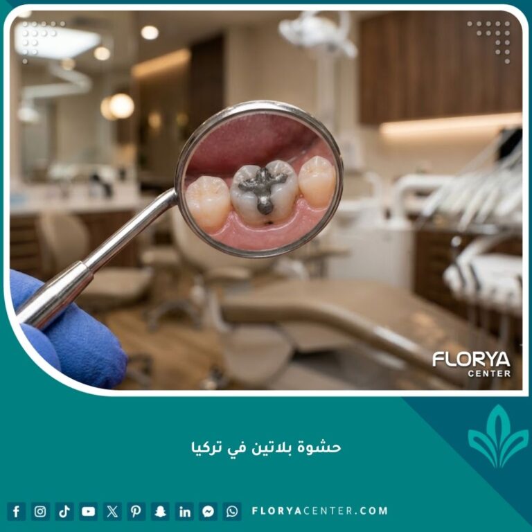 صورة مقربة تعكس حشوة بلاتين في تركيا داخل عيادة أسنان حديثة.