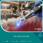 صورة مقربة لأداة ليزر أسنان حديثة تسلط ضوءها على اللثة، تمثل تقنية خلع الأسنان بالليزر في تركيا لتقليل النزيف.