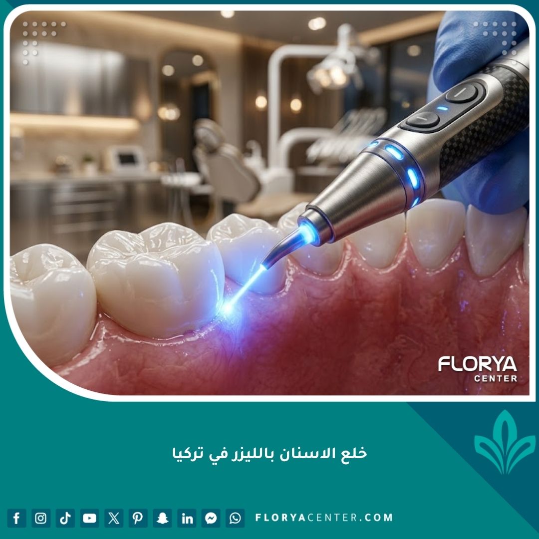 صورة مقربة لأداة ليزر أسنان حديثة تسلط ضوءها على اللثة، تمثل تقنية خلع الأسنان بالليزر في تركيا لتقليل النزيف.