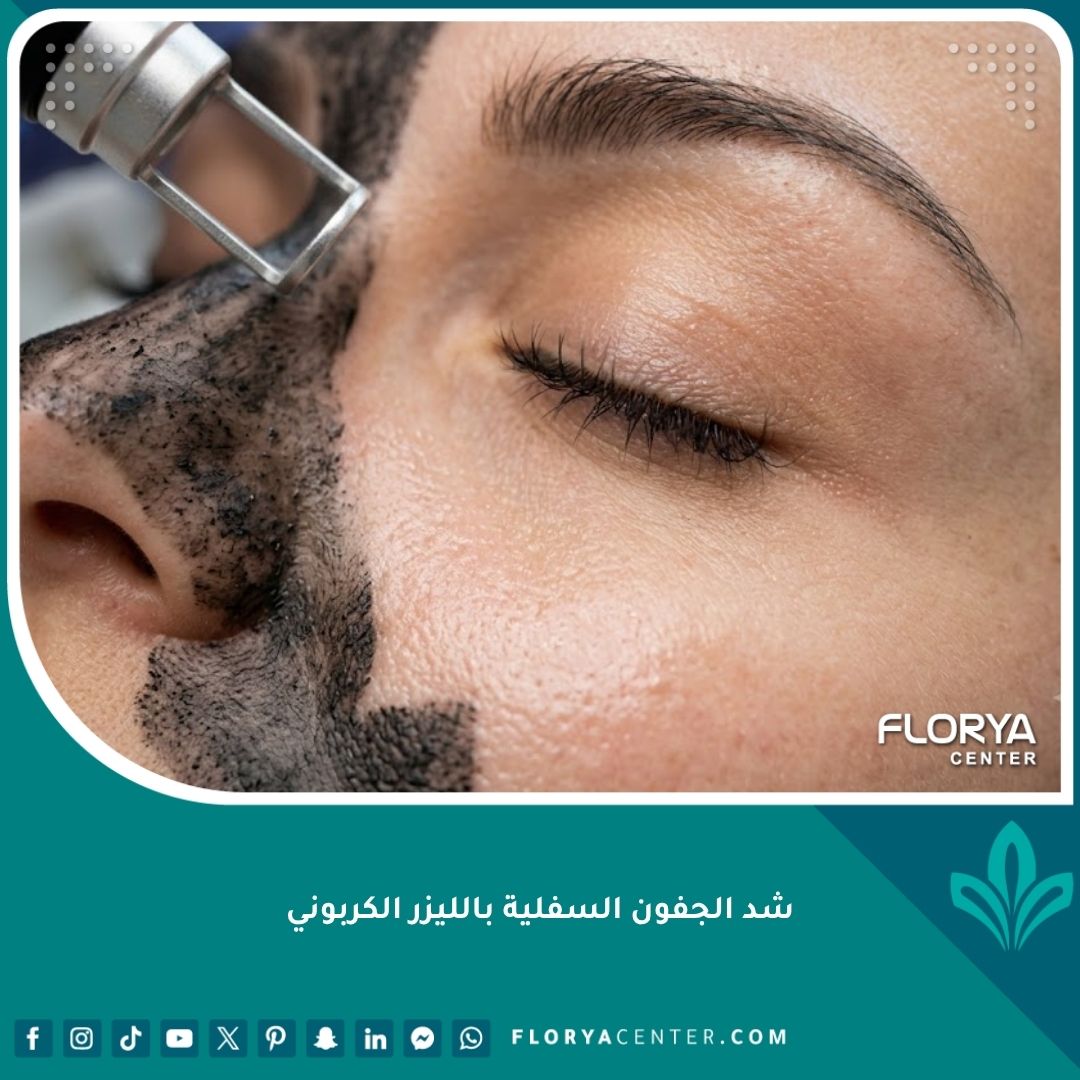 صورة مقربة توضح علاج الهالات وتفتيح البشرة تحت العين باستخدام الليزر الكربوني وليس شد الجفون.
