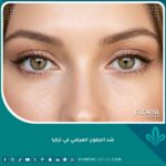صورة مقربة تبرز جمال العيون اللوزية بعد عملية شد الجفون العرضي في تركيا.