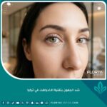 نتائج شد الجفون بتقنية الاندولفت بدون جراحة للحصول على عيون شابة ومشدودة.
