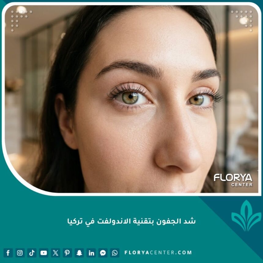 نتائج شد الجفون بتقنية الاندولفت بدون جراحة للحصول على عيون شابة ومشدودة.