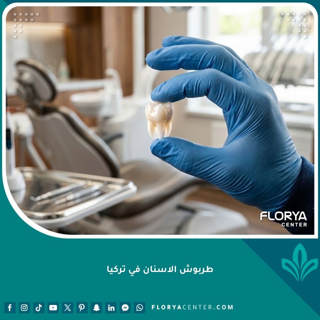 صورة مقربة تظهر طربوش الاسنان الخزفي عالي الجودة بين يدي طبيب أسنان، التحضير لتركيب تلبيسة لحماية السن التالف.