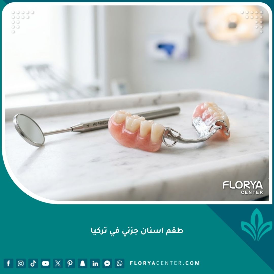 طقم أسنان جزئي متحرك عالي الجودة على صينية طبية، الخيار الأمثل لتعويض الأسنان المفقودة في تركيا