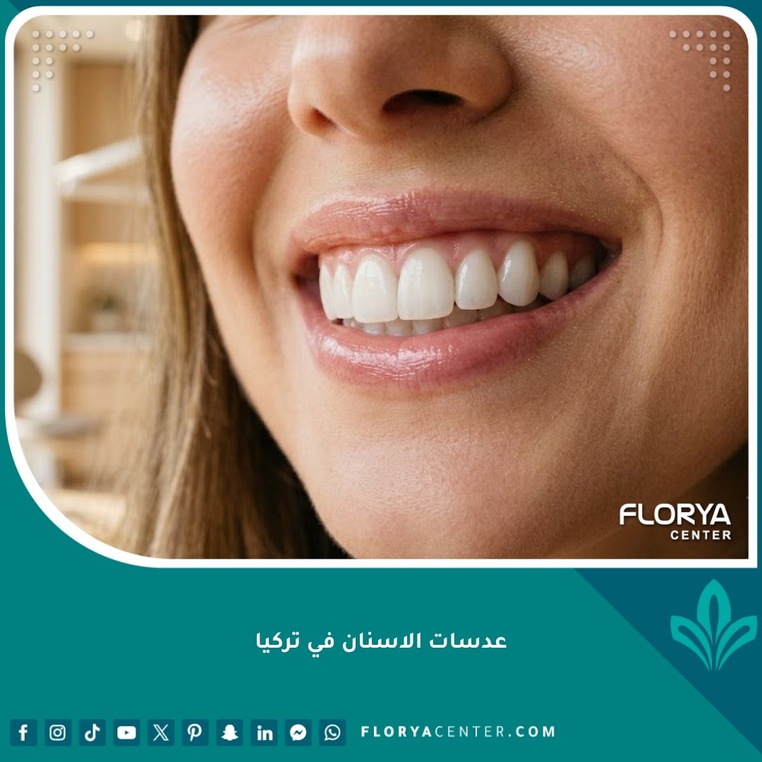 صورة مقربة لابتسامة مثالية تظهر جمال وطبيعية عدسات الاسنان وتصميم ابتسامة هوليود.