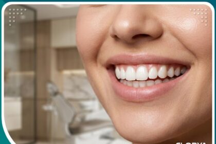صورة مقربة لابتسامة مثالية وجميلة بعد علاج الابتسامة اللثوية في تركيا تظهر التناسق التام بين اللثة والأسنان.