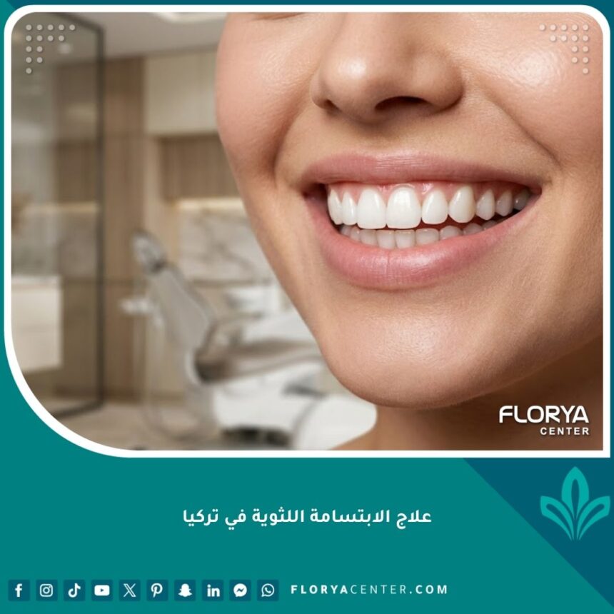 صورة مقربة لابتسامة مثالية وجميلة بعد علاج الابتسامة اللثوية في تركيا تظهر التناسق التام بين اللثة والأسنان.