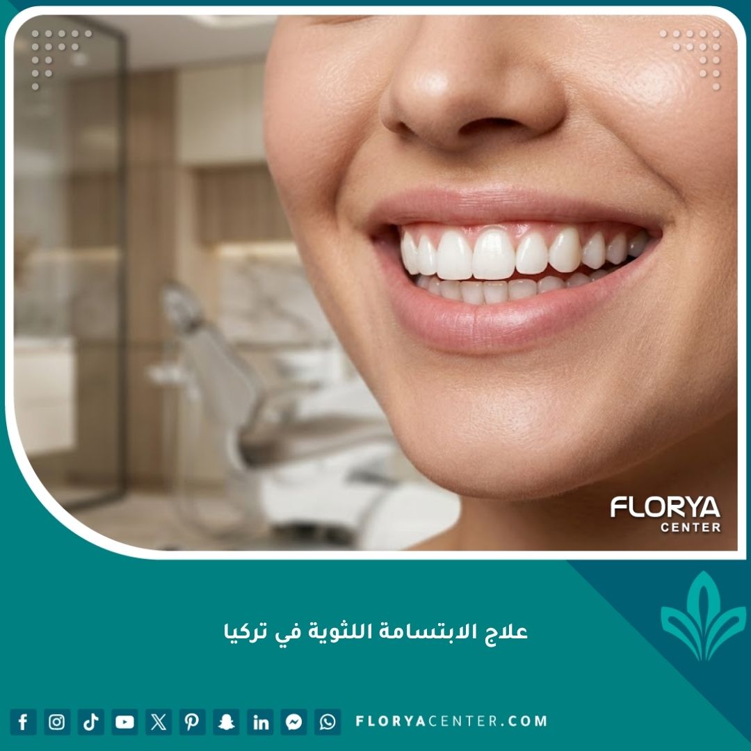 صورة مقربة لابتسامة مثالية وجميلة بعد علاج الابتسامة اللثوية في تركيا تظهر التناسق التام بين اللثة والأسنان.