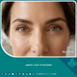 صورة مقربة لامرأة تتمتع بمظهر شاب وعينين مشرقتين بعد عملية إعادة شباب الجفون، تبرز النضارة في النصف العلوي من الوجه.