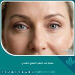 صورة مقربة تظهر نتائج عملية شد الجفن العلوي المتدلي لعيون أكثر شباباً وجاذبية وتخلص تام من ترهلات الجفون.