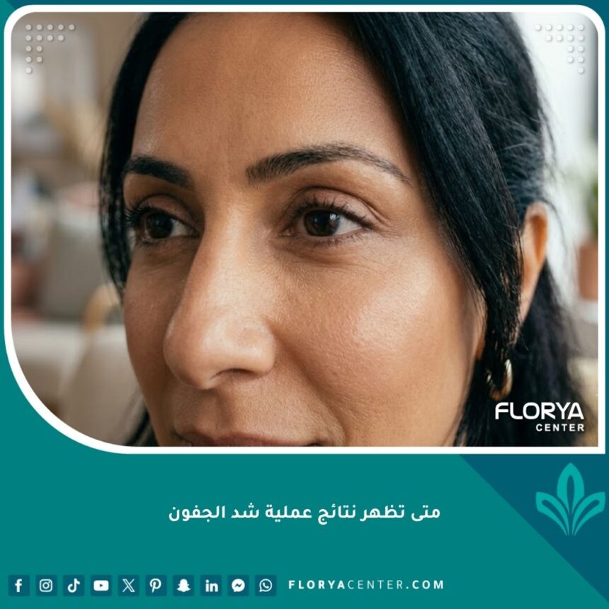 صورة سينمائية لامرأة بعد عملية شد الجفون، تظهر عيونها مشرقة ومشدودة بدون تورم، تعبر عن الرضا والأمل في النتائج النهائية.