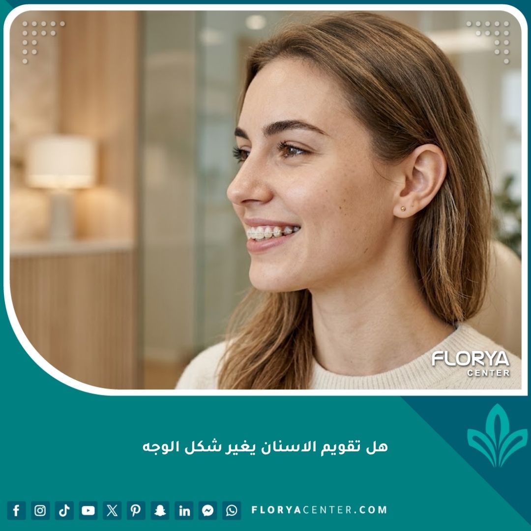 فتاة تبتسم تضع تقويم أسنان يبرز تناسق الشفاه وتأثير تقويم الأسنان على شكل الوجه والبروفايل الجانبي.