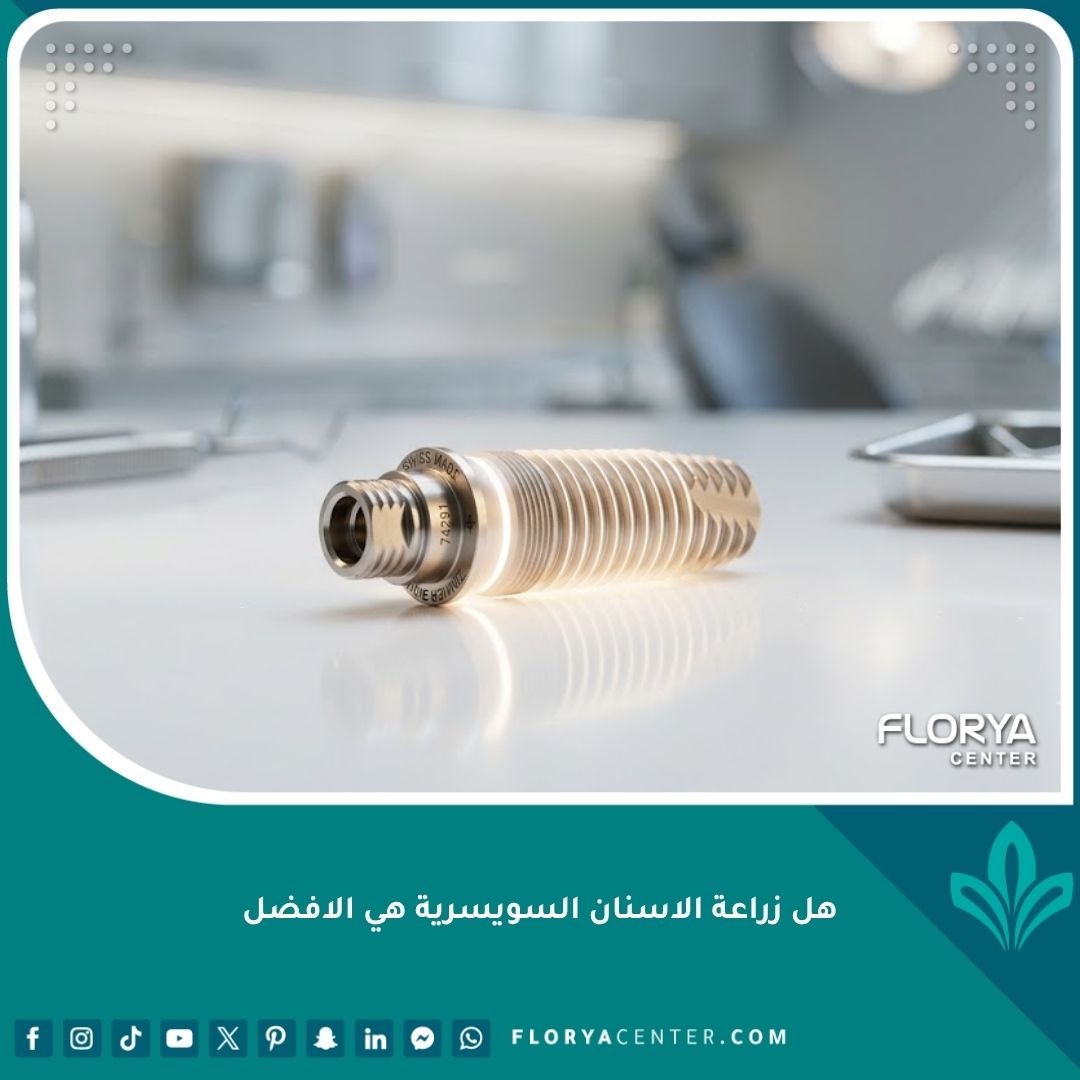 صورة مقربة عالية الدقة توضح جودة وتصميم زراعة الأسنان السويسرية كمعيار ذهبي في طب الأسنان.
