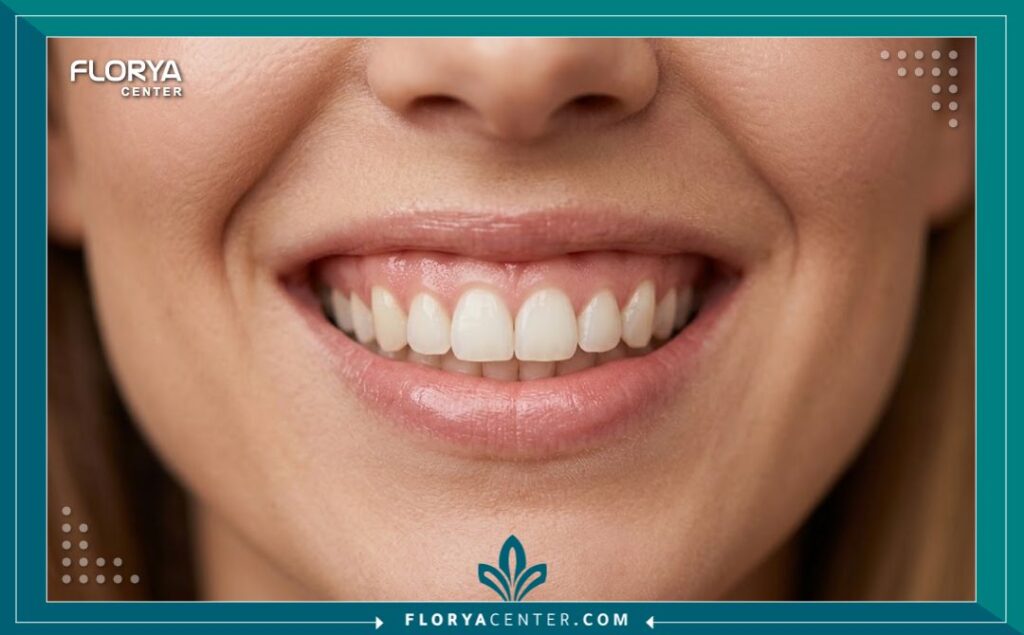 ابتسامة صحية ولثة وردية سليمة بعد نجاح علاج تراجع اللثة وتجميل الابتسامة.