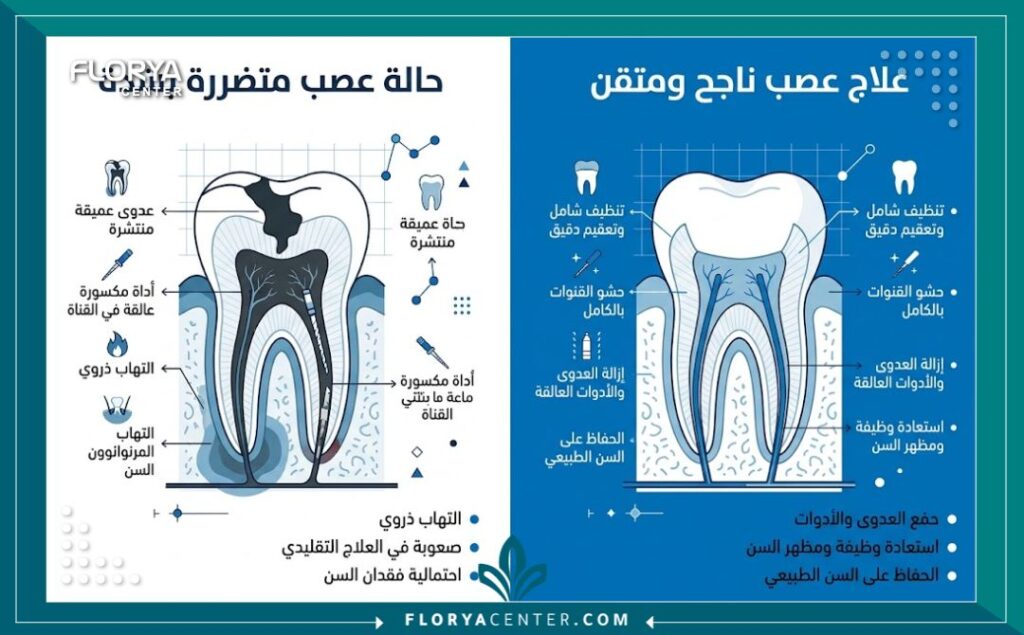 اخصائي علاج عصب في تركيا 3 إنفوجرافيك يوضح الفرق بين حالات العصب المستعصية والسن السليم بعد إعادة المعالجة اللبية