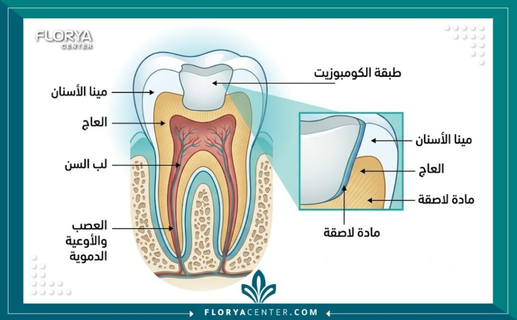 رسم تخطيطي توضيحي لمكونات وطبقات حشوة الكومبوزيت التجميلية للأسنان