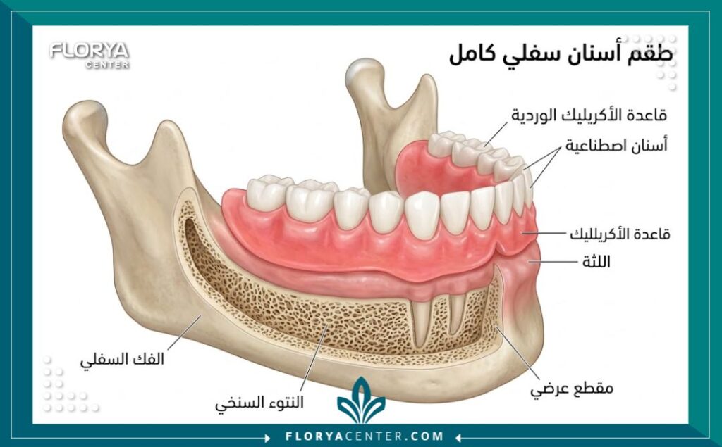 رسم توضيحي طبي يوضح تصميم ومكونات طقم الأسنان الأكريليك الكامل ومطابقته للفك