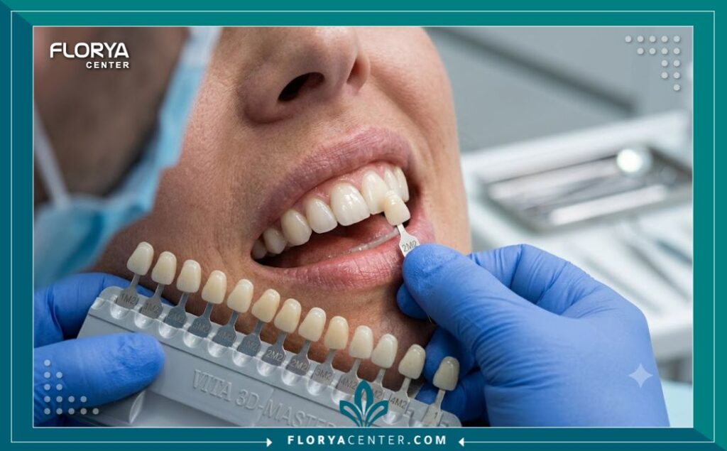 طبيب أسنان يختار درجة اللون المناسبة لعدسات الأسنان التجميلية للحصول على ابتسامة طبيعية