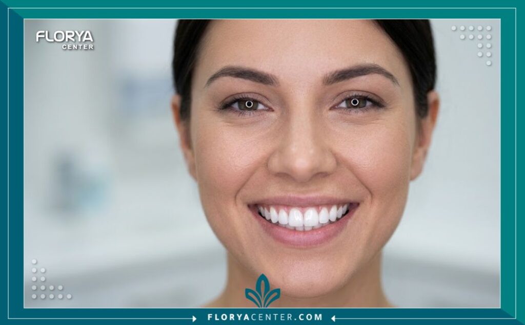 اسعار علاج الاسنان في تركيا 5 ابتسامة ناصعة البياض وجذابة بعد الاستفادة من عروض اسعار تجميل الاسنان في تركيا