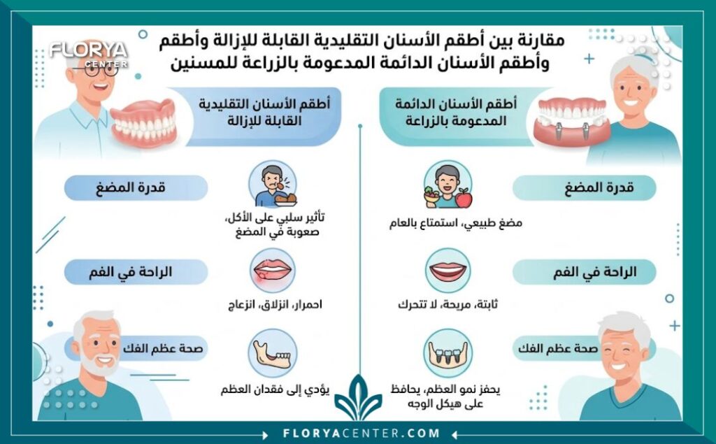 اسنان كبار السن 3 إنفوجرافيك طبي يقارن بين أطقم الأسنان التقليدية والتركيبات المدعومة بالزراعة لكبار السن من حيث قوة المضغ وثبات اسنان كبار السن.