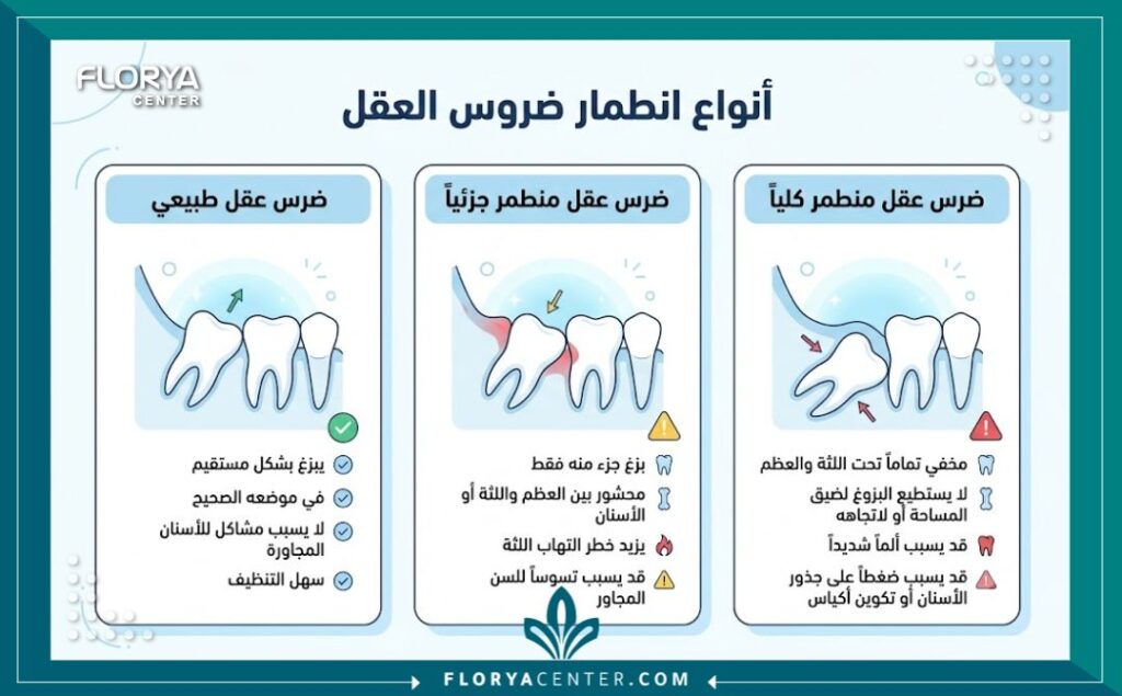 افضل دكتور خلع ضرس العقل في تركيا 3 إنفوجرافيك طبي يقارن بين حالات ضرس العقل الطبيعي والمطمور الذي يتطلب تدخلاً من افضل دكتور خلع ضرس العقل في تركيا.