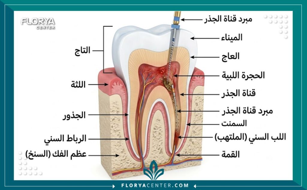 افضل دكتور سحب عصب في تركيا 2 رسم توضيحي طبي يشرح تشريح السن وعملية تنظيف قنوات الجذور وسحب العصب التالف بدقة.