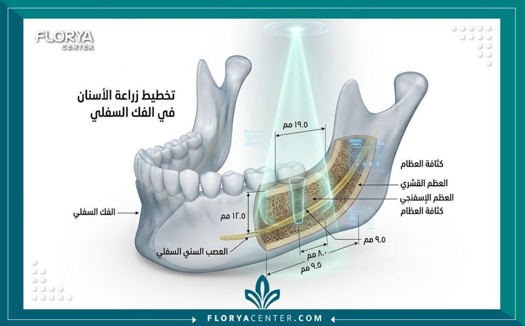 التصوير المقطعي المخروطي في تركيا 2 رسم توضيحي يوضح دقة التصوير المقطعي المخروطي في قياس حجم عظم الفك بالمليمتر