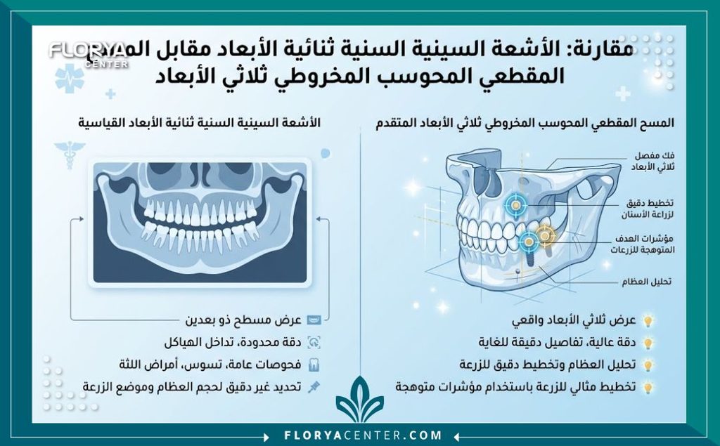 التصوير المقطعي المخروطي في تركيا 3 إنفوجرافيك يقارن بين التصوير المقطعي المخروطي في تركيا العادية وأشعة CBCT ثلاثية الأبعاد لزراعة الأسنان